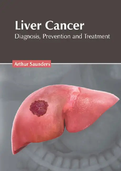 Liver Cancer: Diagnosis, Prevention and Treatment by Arthur Saunders