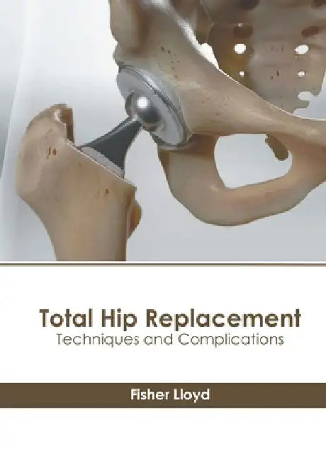 Total Hip Replacement: Techniques and Complications by Fisher Lloyd