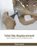 Total Hip Replacement: Techniques and Complications by Fisher Lloyd