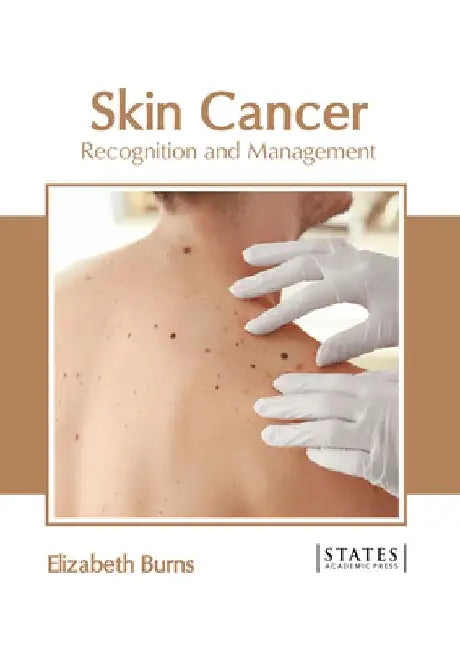 Skin Cancer: Recognition and Management by Elizabeth Burns