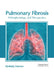 Pulmonary Fibrosis: Pathophysiology and Therapeutics by Kimberly Dawson
