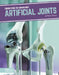 Artificial Joints by Marne Ventura