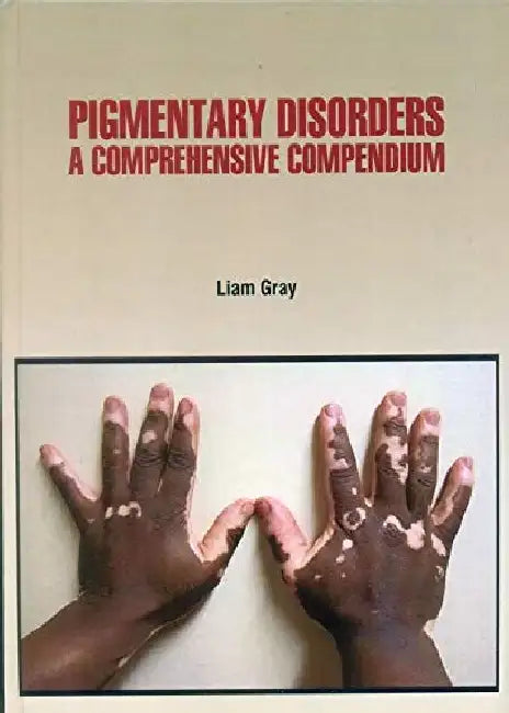 Pigmentary Disorders A Comprehensive Compendium by Gray L.