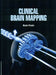Clinical Brain Mapping by Peake K.