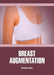 Breast Augmentation by Ross C.