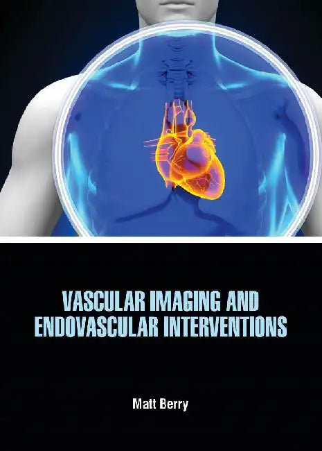 Vascular Imaging And Endovascular Interventions by Matt Berry
