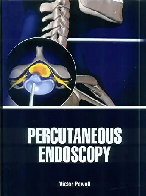 Percutaneous Endoscopy by Powell V.