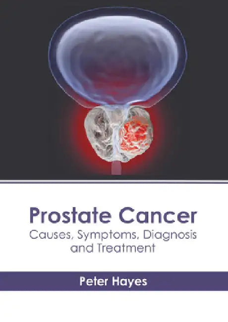 Prostate Cancer: Causes, Symptoms, Diagnosis and Treatment by Peter Hayes