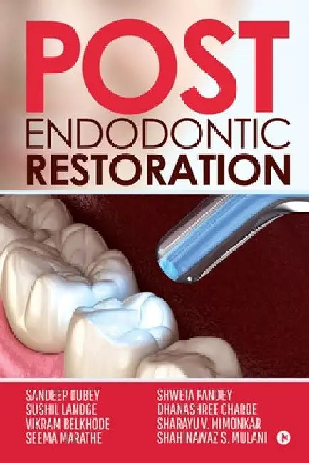 Post Endodontic Restoration by Sandeep Dubey