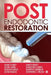 Post Endodontic Restoration by Sandeep Dubey