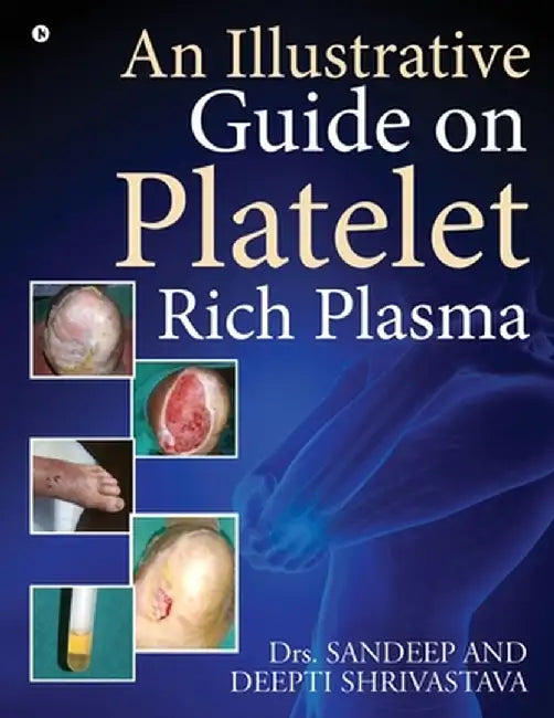 An Illustrative Guide on Platelet Rich Plasma by Dr Sandeep