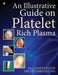 An Illustrative Guide on Platelet Rich Plasma by Dr Sandeep