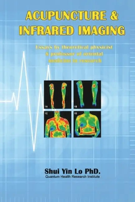 Acupuncture and Infrared Imaging: Essays by theoretical physicist & professor of oriental medicine in research by Shui Yin Lo
