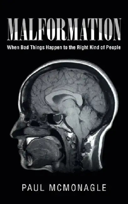 Malformation: When Bad Things Happen to the Right Kind of People by Paul McMonagle