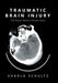 Traumatic Brain Injury: The Pastor Robert Schultz Story by Sharla Schultz