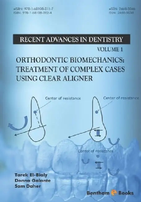 Orthodontic Biomechanics: Treatment Of Complex Cases Using Clear Aligner by Donna Galante