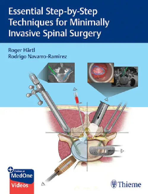 Essential Step-By-Step Techniques for Minimally Invasive Spinal Surgery by Roger Hartl, Rodrigo Navarro-Ramirez