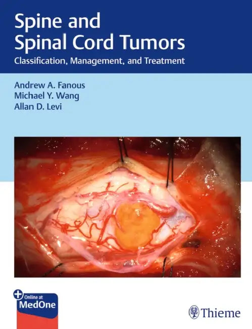 Spine and Spinal Cord Tumors: Classification, Management, and Treatment by Andrew Fanous, Michael Wang, Allan Levi