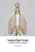 Surgical Back Fusion by Martha Gilliland