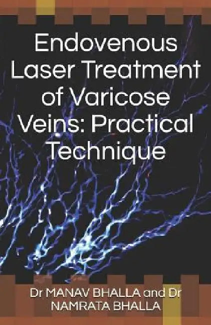 Endovenous Laser Treatment of Varicose Veins: Practical Technique by Namrata Bhalla