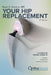 Your Hip Replacement (Updated and Expanded Second Edition): A Complete Patient Guide to Surgery, Recovery, and Long-Term Success by Ryan Koonce