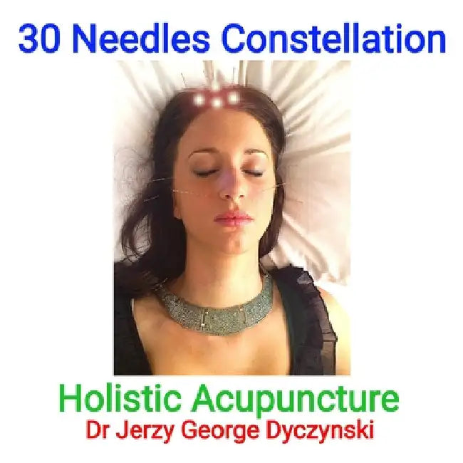 30 Needles Constellation Acupuncture: Holistic Acupuncture by Dyczynski, Jerzy George