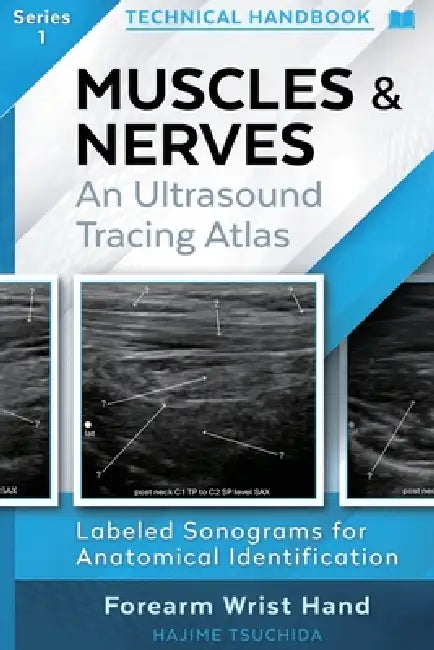 Technical Ultrasound Handbook - Muscles & Nerves: An Ultrasound Tracing Atlas (Series 1) by Hajime Tsuchida