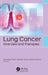 Lung Cancer: Overview and Therapies by Abhishek Tiwari, Varsha Tiwari, Manish Kumar