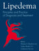 Lipedema: Principles and Practice of Diagnosis and Treatment