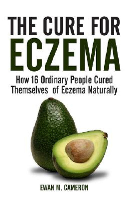 The Cure for Eczema by Ewan M. Cameron