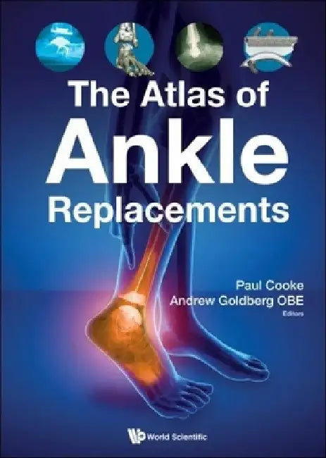 The Atlas of Ankle Replacements by Goldberg Obe, Andrew J.