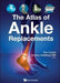 The Atlas of Ankle Replacements by Goldberg Obe, Andrew J.