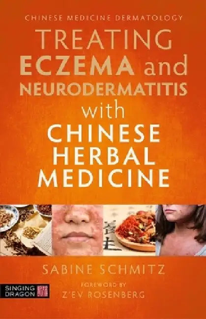 Treating Eczema with Chinese Herbal Medicine: A Practical Handbook by Sabine Schmitz