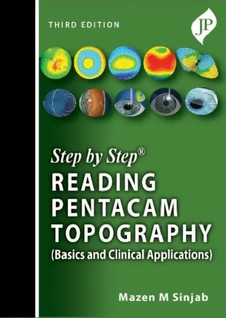 Step By Step Reading Pentacam Topography (Basics And Clinical Applications) by Mazen M Sinjab