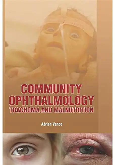 Community Ophthalmology Trachoma And Malnutrition by Vance A.