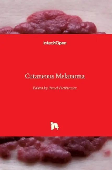 Cutaneous Melanoma by Pawel Pietkiewicz