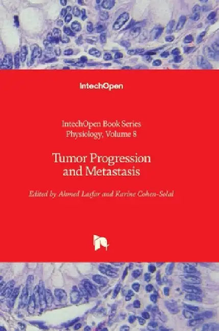 Tumor Progression and Metastasis by Catala, Angel