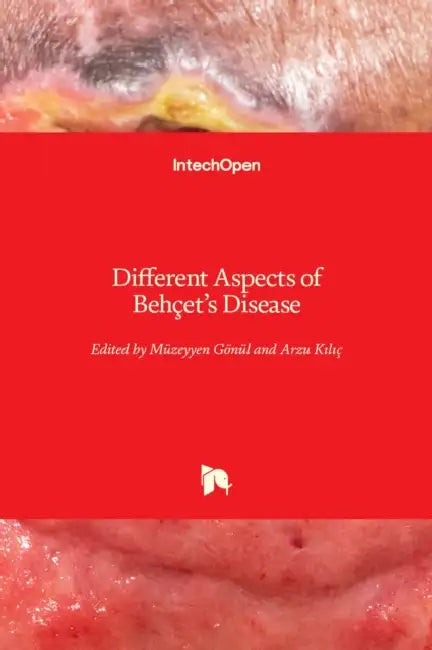 Different Aspects of Behçet's Disease by Müzeyyen Gönül, Arzu Kilic
