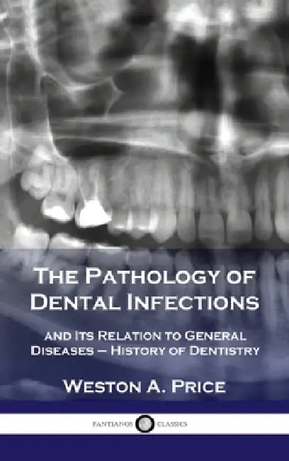 Pathology of Dental Infections: and Its Relation to General Diseases - History of Dentistry by Weston a. Price