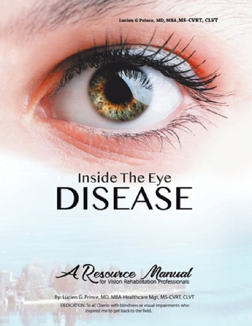 Inside the Eye Disease Just the Facts: A Resource Manual for the Vision Rehabilitation Professionals by Prince MD Mba-Healthcare Mgt Ms-Cvrt CLV