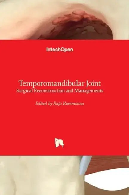 Temporomandibular Joint - Surgical Reconstruction and Managements by Raja Kummoona