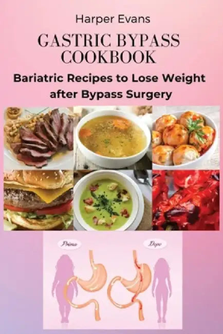 Gastric Bypass Cookbook: Bariatric Recipes to Lose Weight after Bypass Surgery by Harper Evans