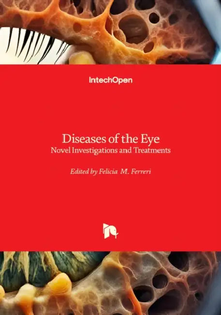 Diseases of the Eye - Novel Investigations and Treatments: Novel Investigations and Treatments by Felicia M. Ferreri