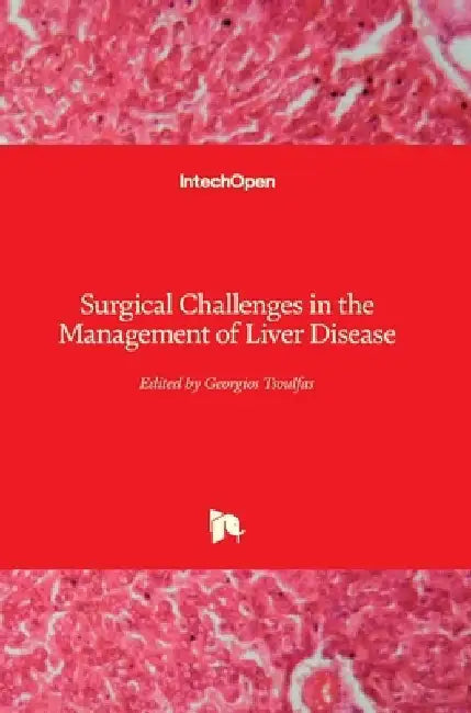 Surgical Challenges in the Management of Liver Disease by Georgios Tsoulfas