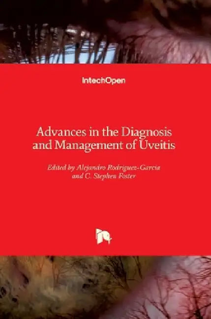 Advances in the Diagnosis and Management of Uveitis by Alejandro Rodriguez-Garcia