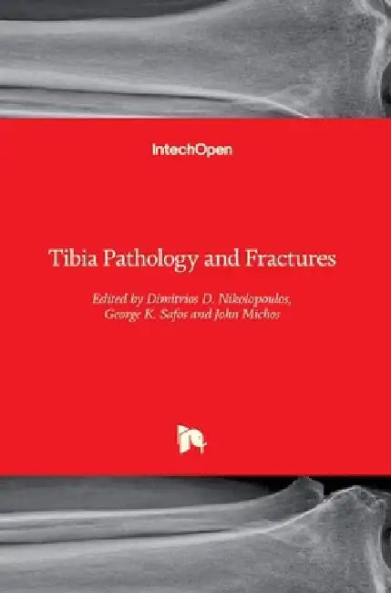 Tibia Pathology and Fractures by Dimitrios D. Nikolopoulos