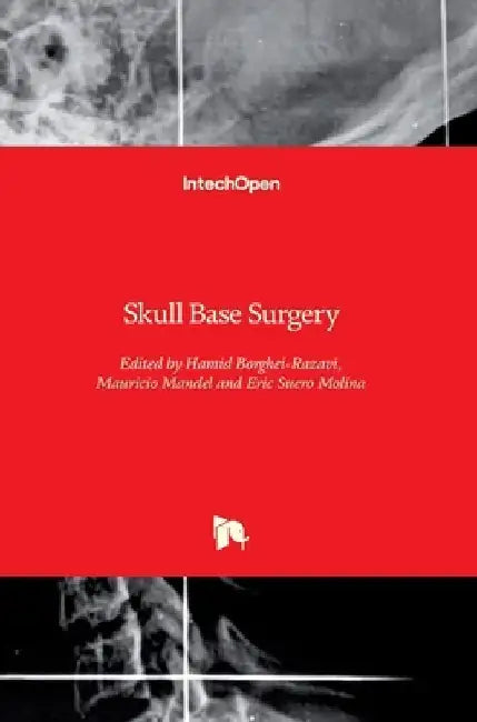 Skull Base Surgery by Hamid Borghei-Razavi