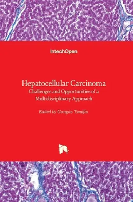 Hepatocellular Carcinoma: Challenges and Opportunities of a Multidisciplinary Approach by Georgios Tsoulfas