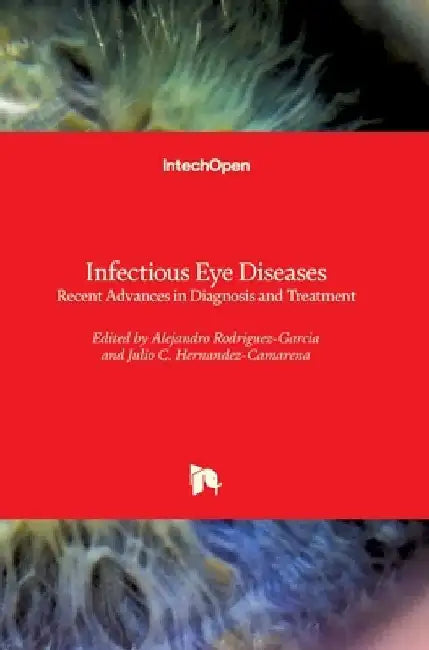 Infectious Eye Diseases: Recent Advances in Diagnosis and Treatment by Alejandro Rodriguez-Garcia