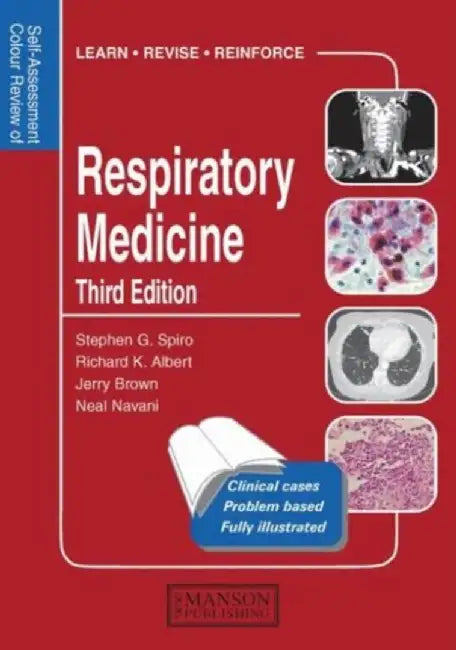 Respiratory Medicine by Stephen Spiro